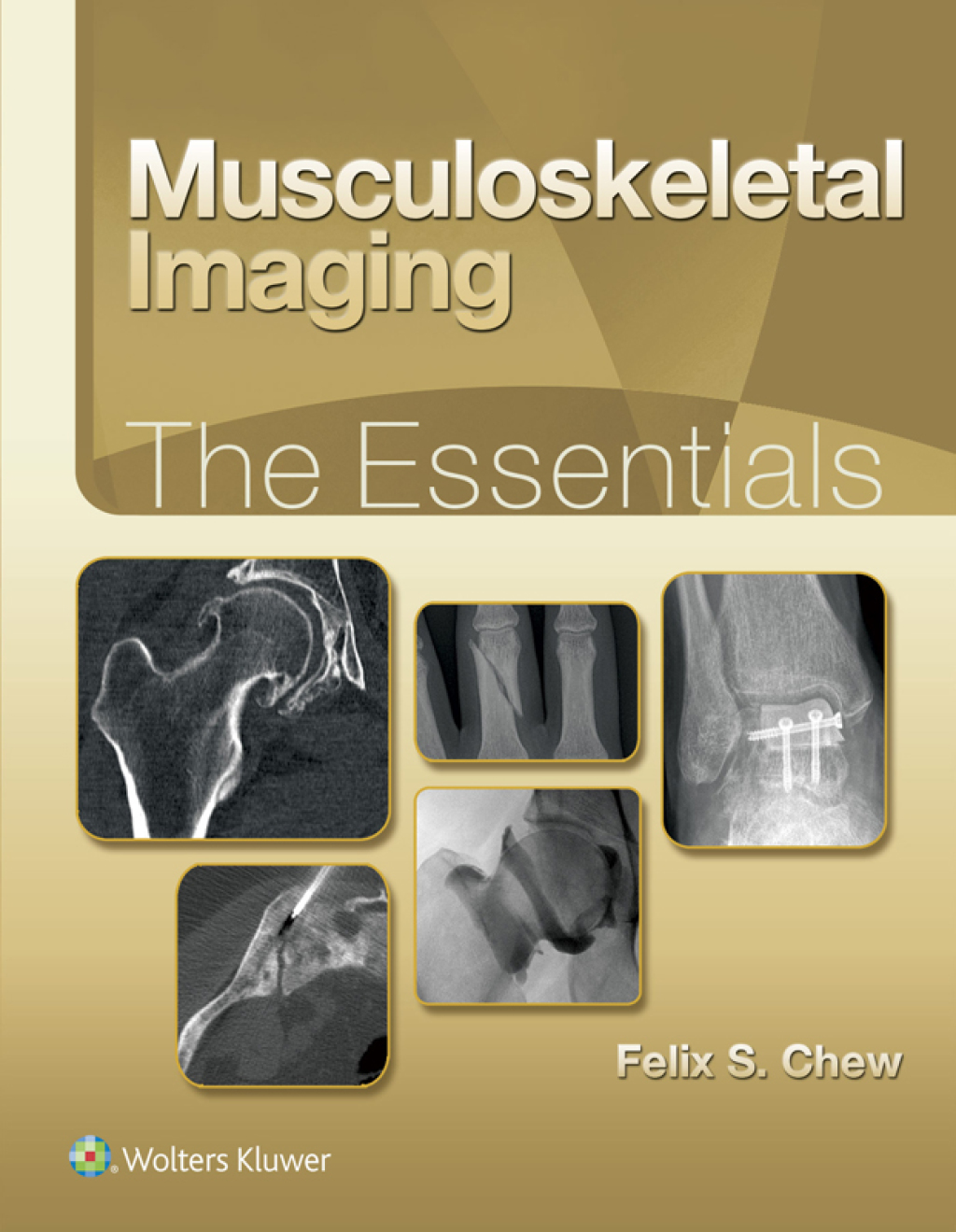 Musculoskeletal Imaging: The Essentials  â€“ PDF/EPUB Version Downloadable