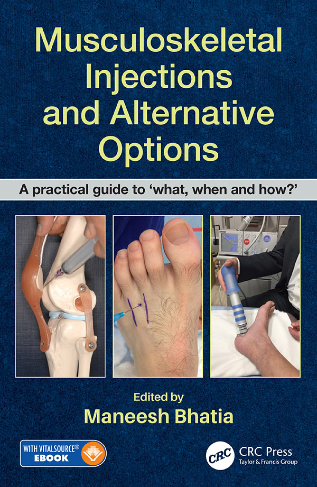 Musculoskeletal Injections and Alternative Options A practical guide to 'what, when and how?' 1st Edition â€“ PDF/EPUB Version Downloadable