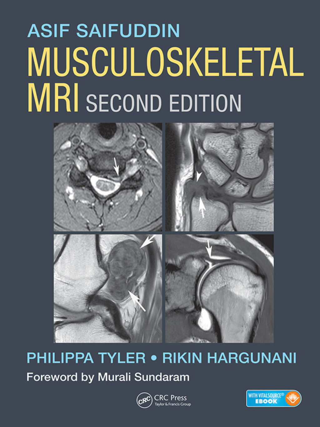 Musculoskeletal MRI 2nd Edition â€“ PDF/EPUB Version Downloadable