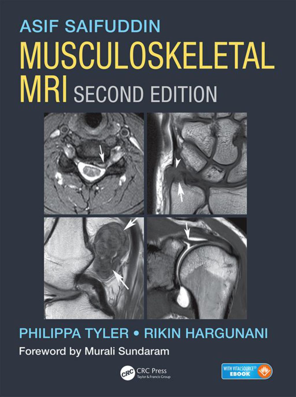 Musculoskeletal MRI 2nd Edition â€“ PDF/EPUB Version Downloadable