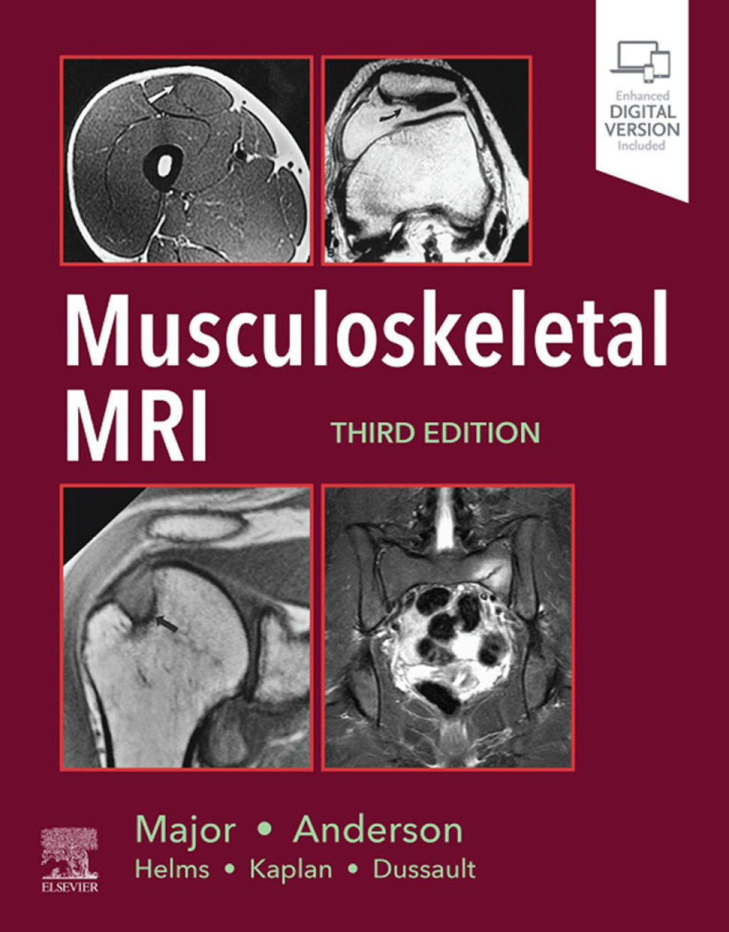 Musculoskeletal MRI 3rd Edition â€“ PDF/EPUB Version Downloadable