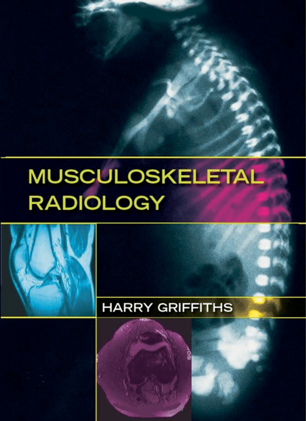 Musculoskeletal Radiology 1st Edition â€“ PDF/EPUB Version Downloadable