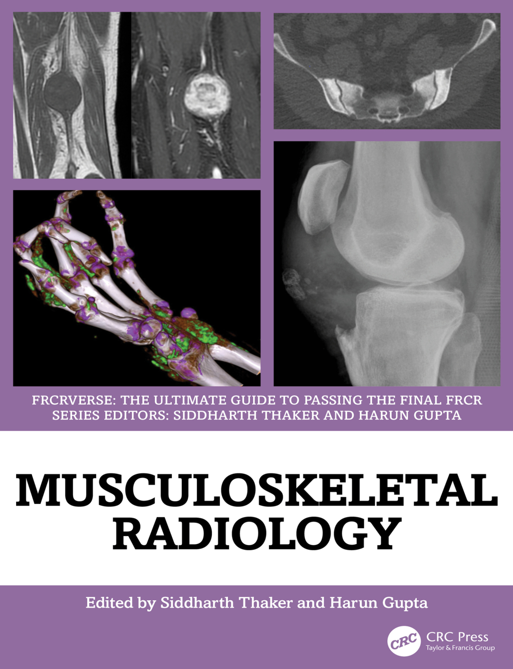 Musculoskeletal Radiology An Ultimate Guide to Passing the Final FRCR 1st Edition â€“ PDF/EPUB Version Downloadable