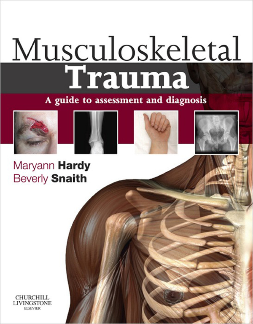 Musculoskeletal Trauma A Guide to Assessment and Diagnosis  â€“ PDF/EPUB Version Downloadable