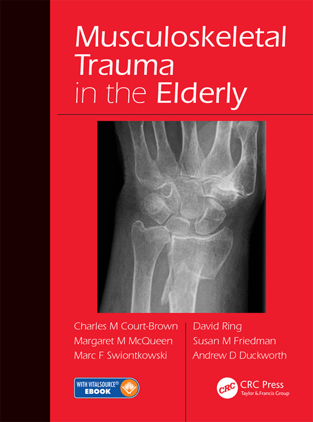 Musculoskeletal Trauma in the Elderly 1st Edition â€“ PDF/EPUB Version Downloadable