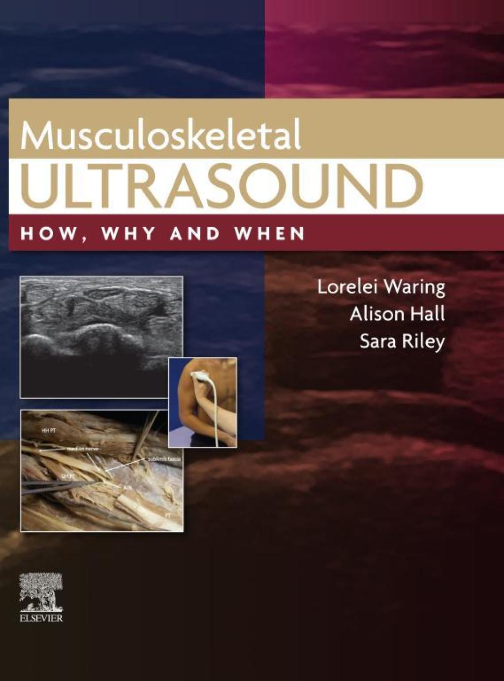 Musculoskeletal Ultrasound 1st Edition â€“ PDF/EPUB Version Downloadable