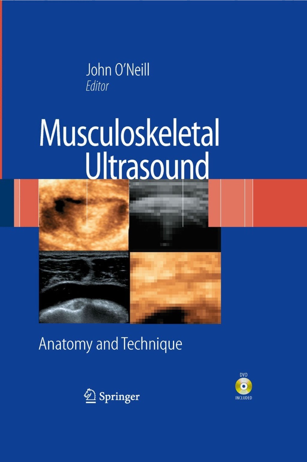Musculoskeletal Ultrasound Anatomy and Technique 1st Edition â€“ PDF/EPUB Version Downloadable