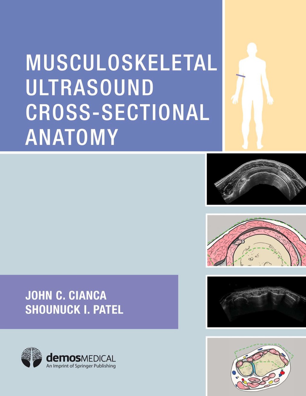 Musculoskeletal Ultrasound Cross-Sectional Anatomy 1st Edition â€“ PDF/EPUB Version Downloadable