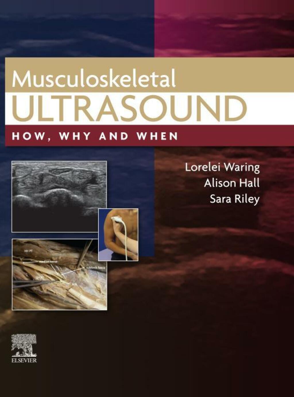 Musculoskeletal Ultrasound How, Why and When  â€“ PDF/EPUB Version Downloadable