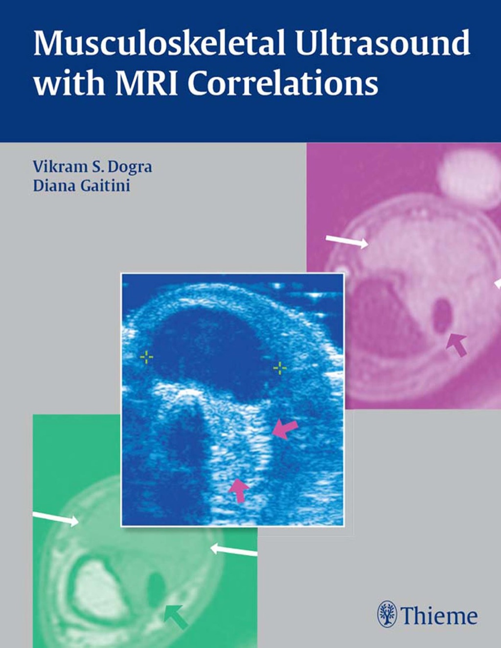 Musculoskeletal Ultrasound with MRI Correlations 1st Edition â€“ PDF/EPUB Version Downloadable