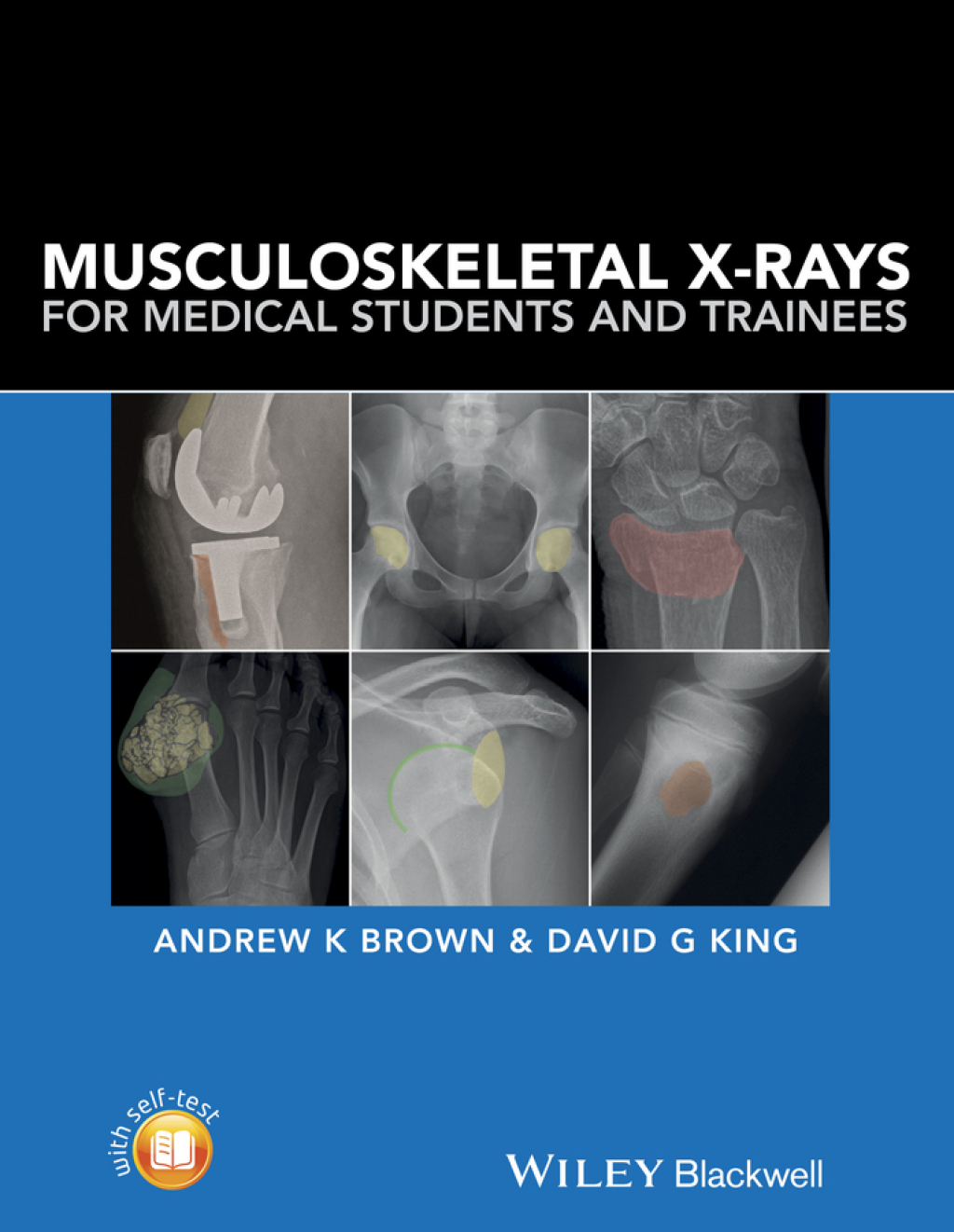 Musculoskeletal X-Rays for Medical Students and Trainees 1st Edition â€“ PDF/EPUB Version Downloadable
