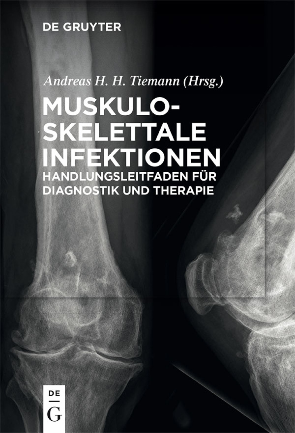 Muskuloskelettale Infektionen Handlungsleitfaden fÃ¼r Diagnostik und Therapie 1st Edition â€“ PDF/EPUB Version Downloadable