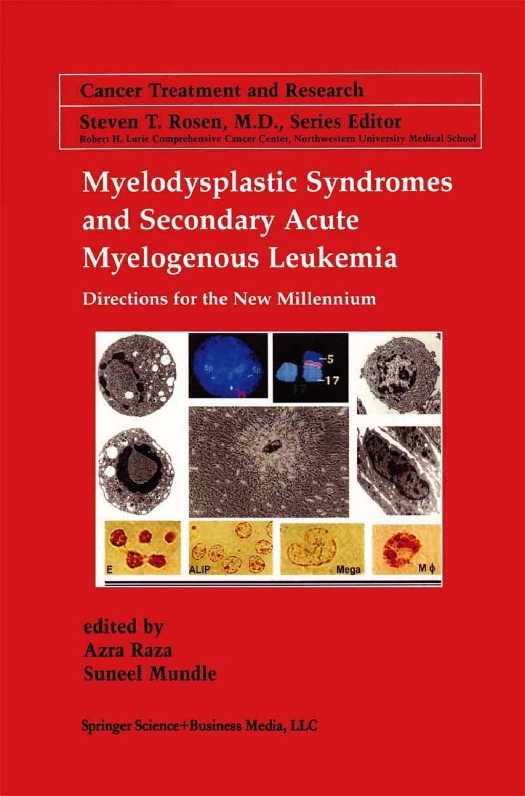 Myelodysplastic Syndromes & Secondary Acute Myelogenous Leukemia Directions for the New Millennium 1st Edition â€“ PDF/EPUB Version Downloadable