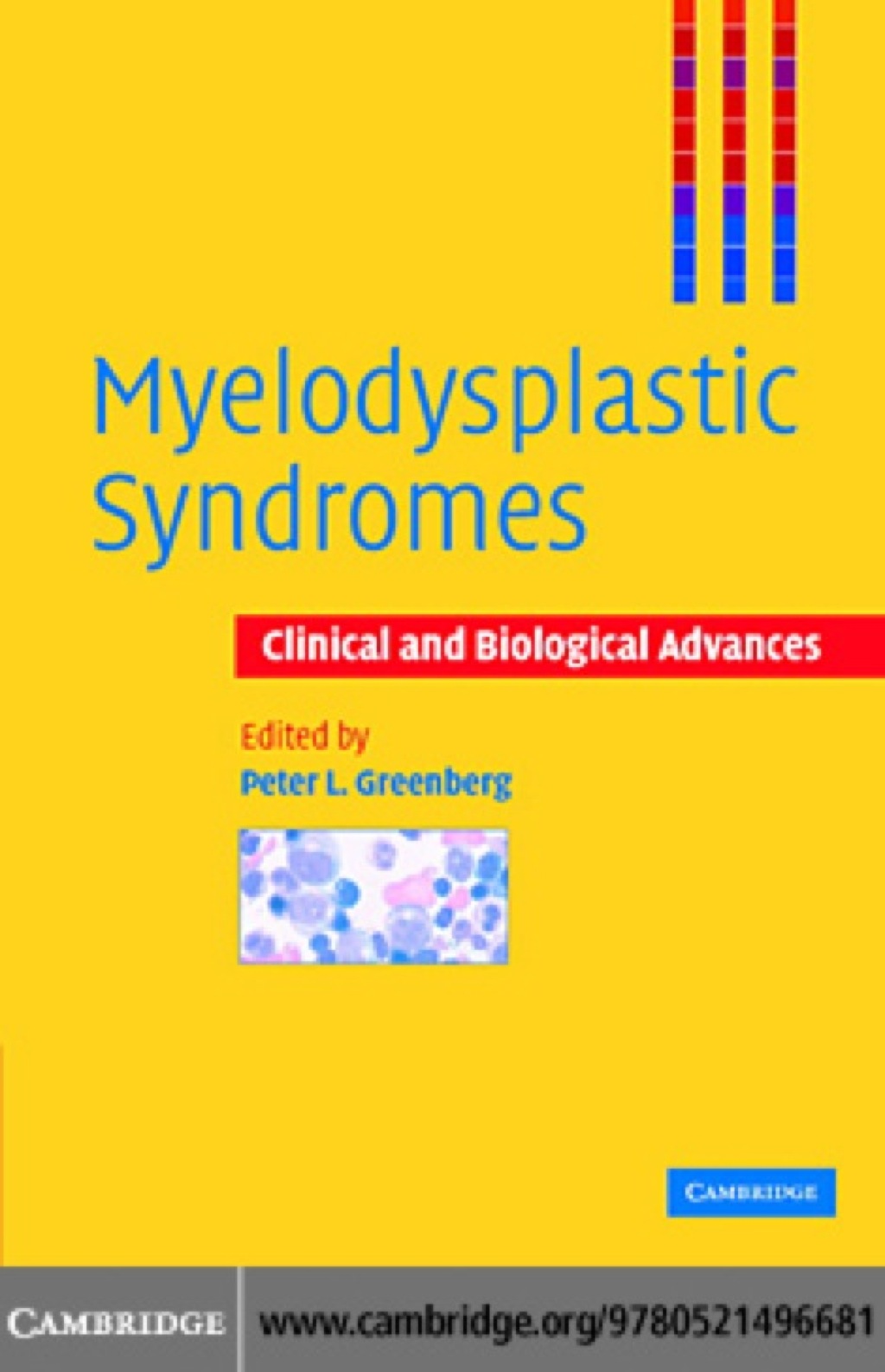 Myelodysplastic Syndromes Clinical and Biological Advances 1st Edition â€“ PDF/EPUB Version Downloadable