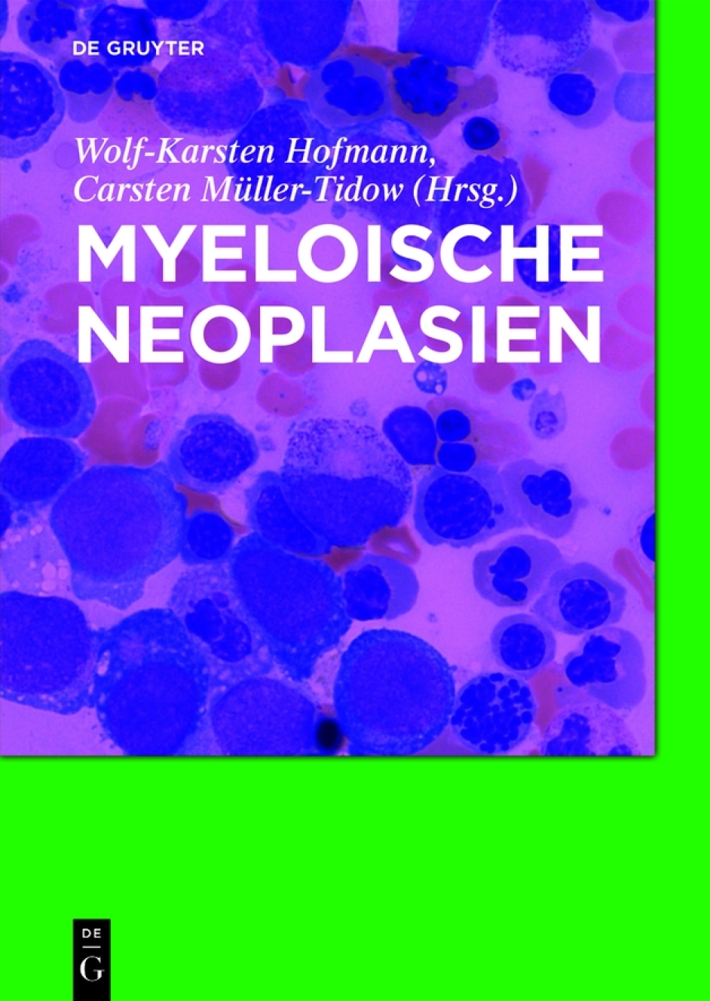 Myeloische Neoplasien 1st Edition â€“ PDF/EPUB Version Downloadable