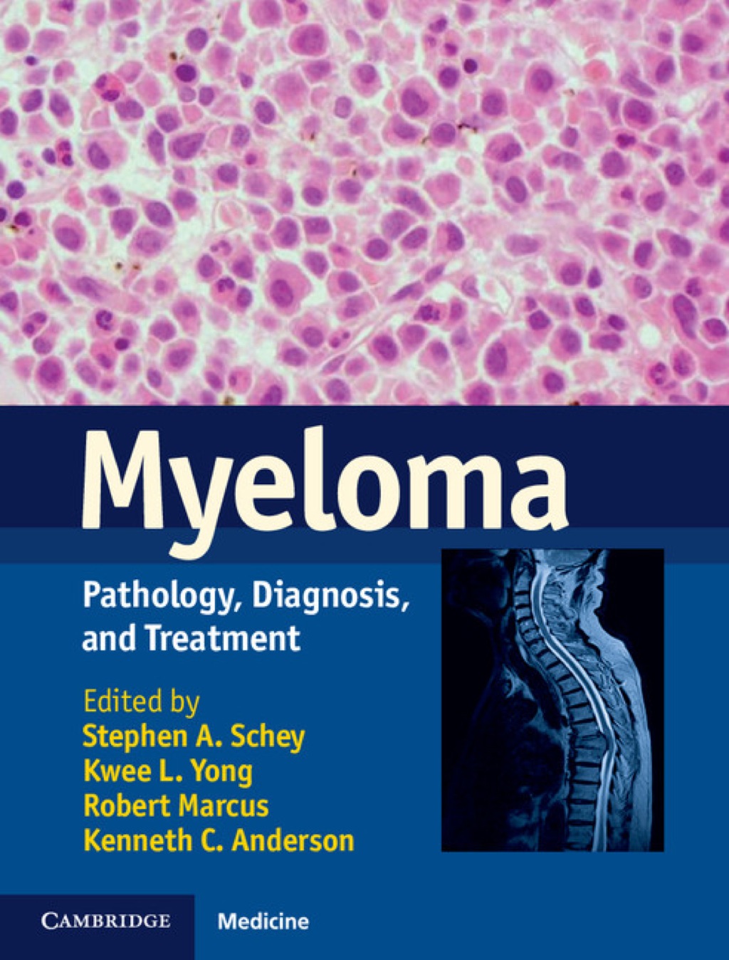 Myeloma Pathology, Diagnosis, and Treatment 1st Edition â€“ PDF/EPUB Version Downloadable
