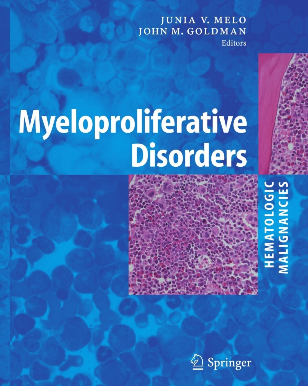 Myeloproliferative Disorders 1st Edition â€“ PDF/EPUB Version Downloadable