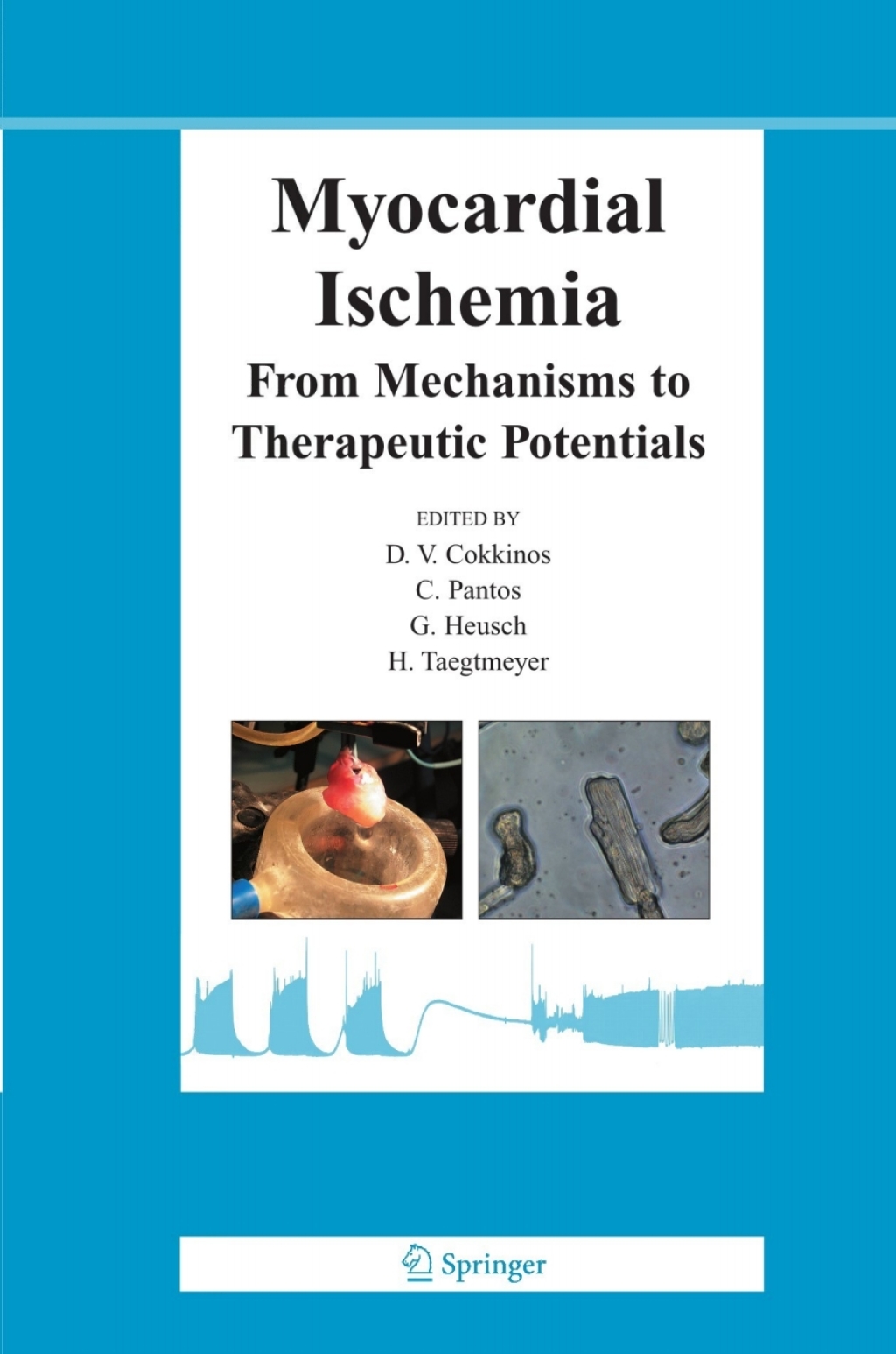 Myocardial Ischemia From Mechanisms to Therapeutic Potentials 1st Edition â€“ PDF/EPUB Version Downloadable