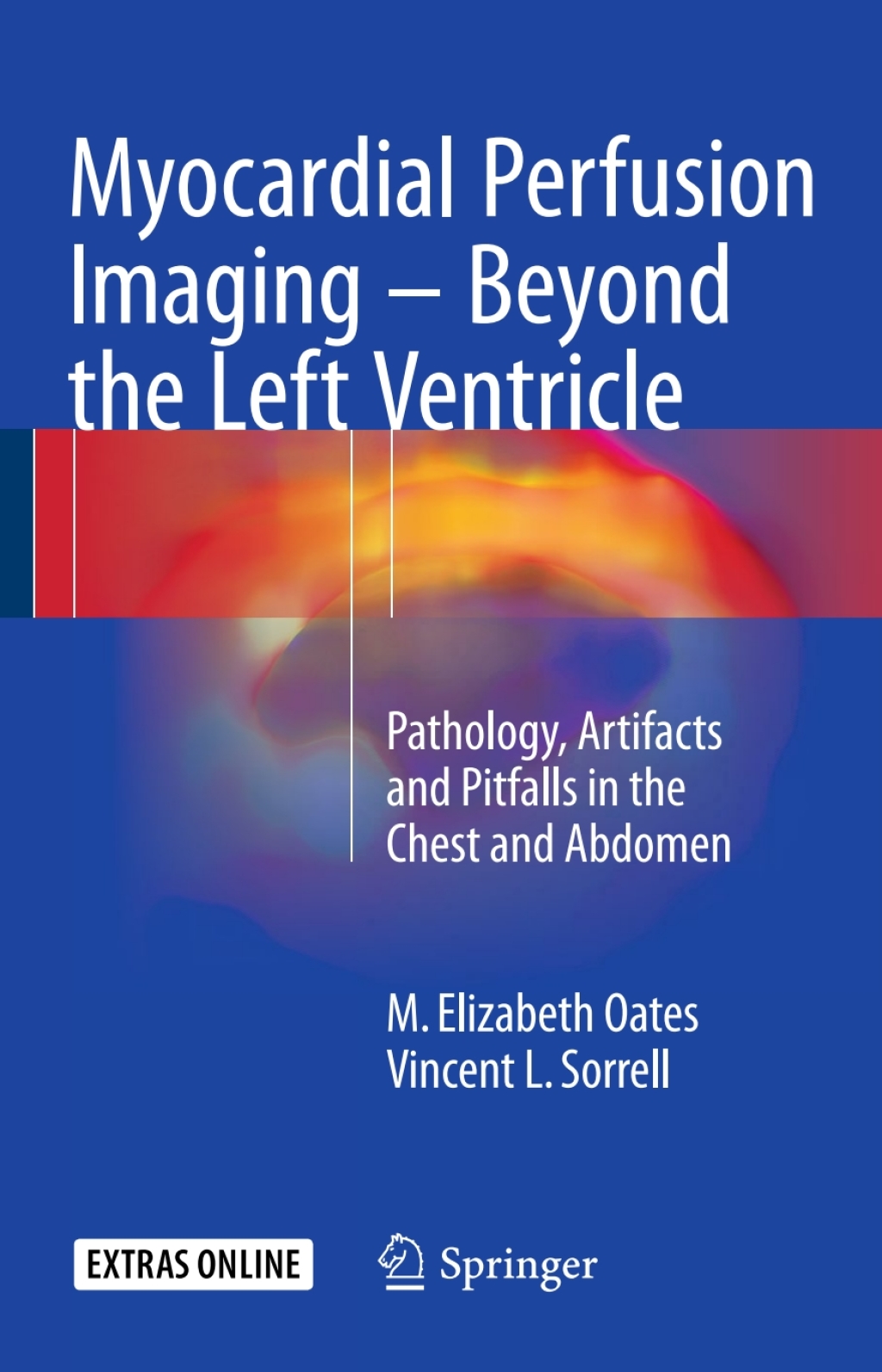 Myocardial Perfusion Imaging - Beyond the Left Ventricle Pathology, Artifacts and Pitfalls in the Chest and Abdomen  â€“ PDF/EPUB Version Downloadable