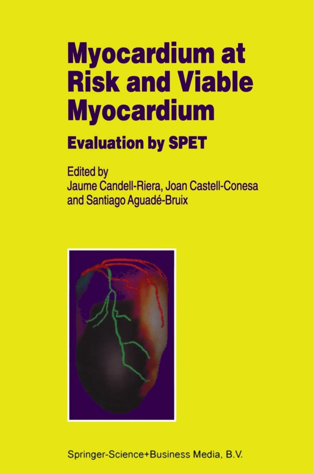 Myocardium at Risk and Viable Myocardium Evaluation by SPET 1st Edition â€“ PDF/EPUB Version Downloadable