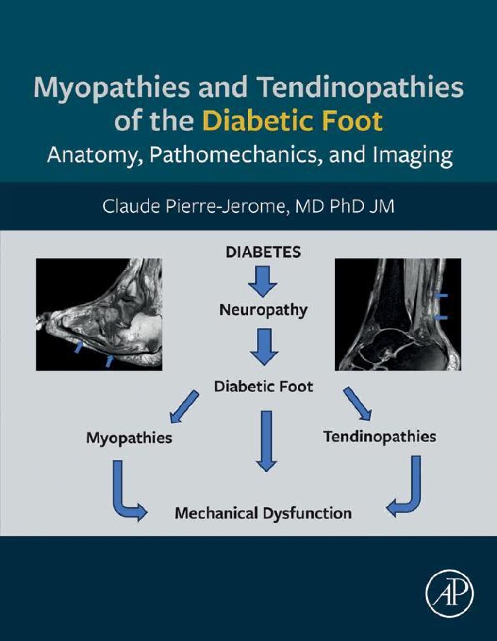 Myopathies and Tendinopathies of the Diabetic Foot Anatomy, Pathomechanics, and Imaging 1st Edition â€“ PDF/EPUB Version Downloadable