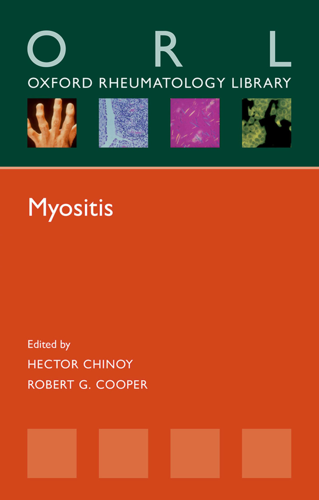 Myositis 1st Edition â€“ PDF/EPUB Version Downloadable