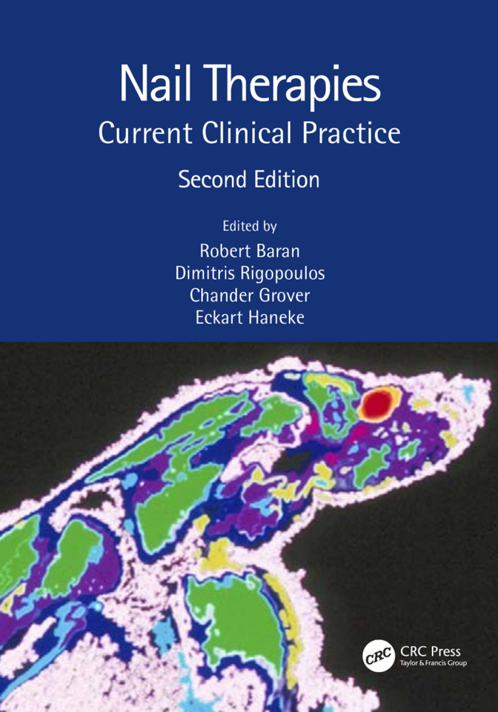 Nail Therapies Current Clinical Practice 2nd Edition â€“ PDF/EPUB Version Downloadable