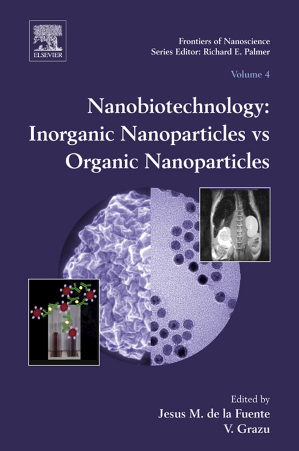 Nanobiotechnology: Inorganic Nanoparticles vs Organic Nanoparticles  â€“ PDF/EPUB Version Downloadable