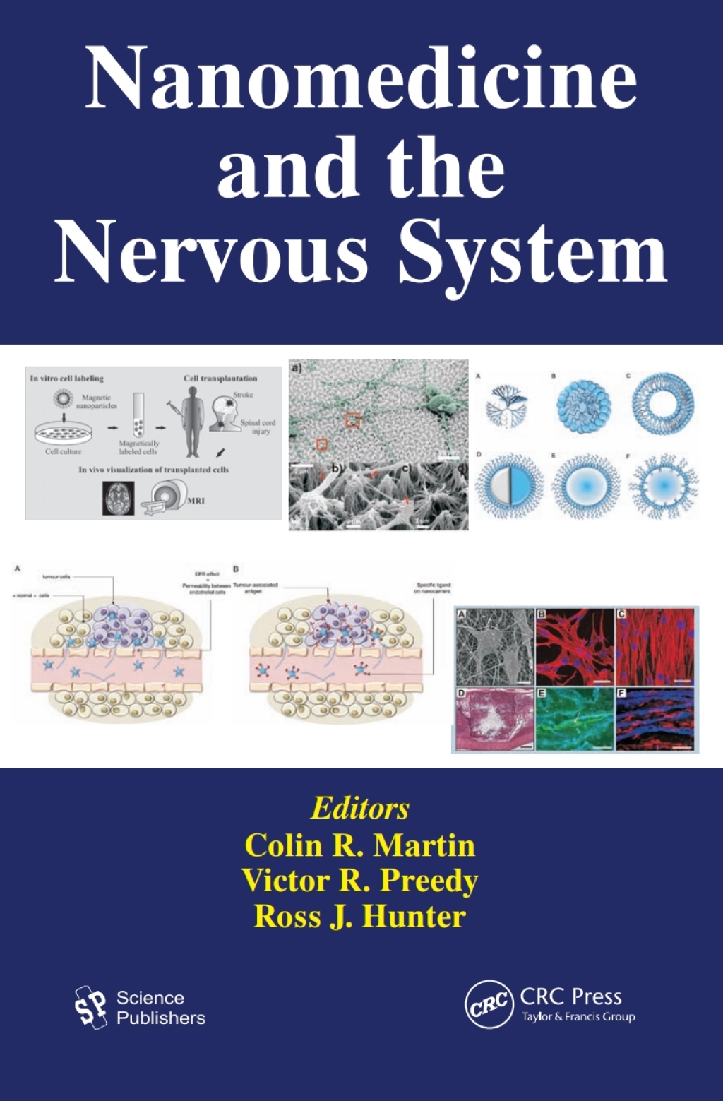 Nanomedicine and the Nervous System 1st Edition â€“ PDF/EPUB Version Downloadable