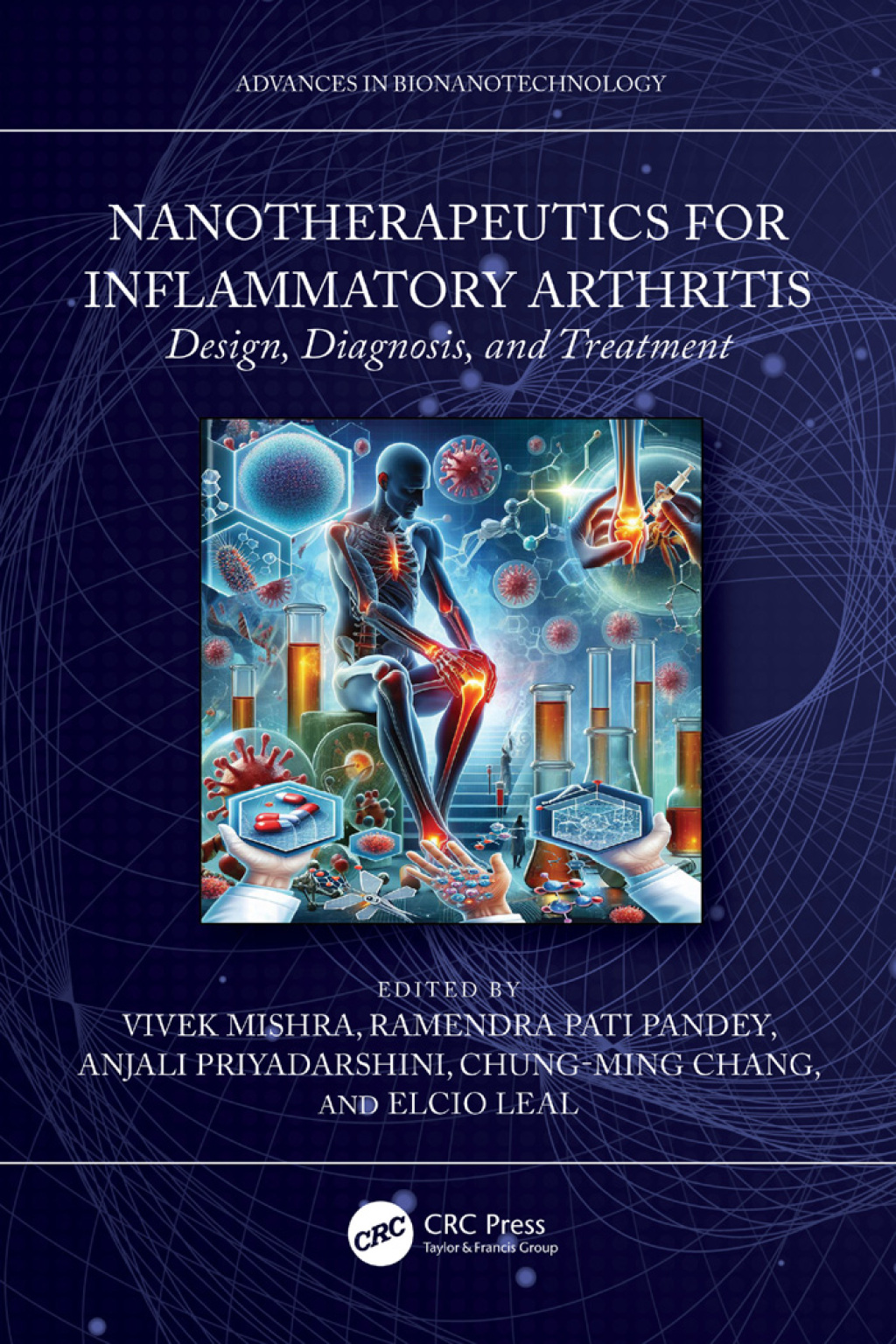Nanotherapeutics for Inflammatory Arthritis Design, Diagnosis, and Treatment 1st Edition â€“ PDF/EPUB Version Downloadable