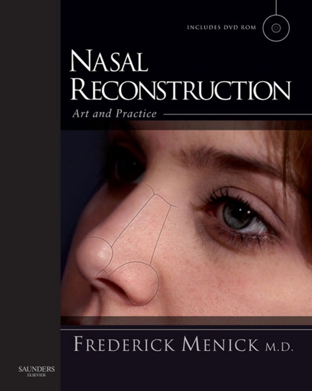 Nasal Reconstruction: Art and Practice  â€“ PDF/EPUB Version Downloadable