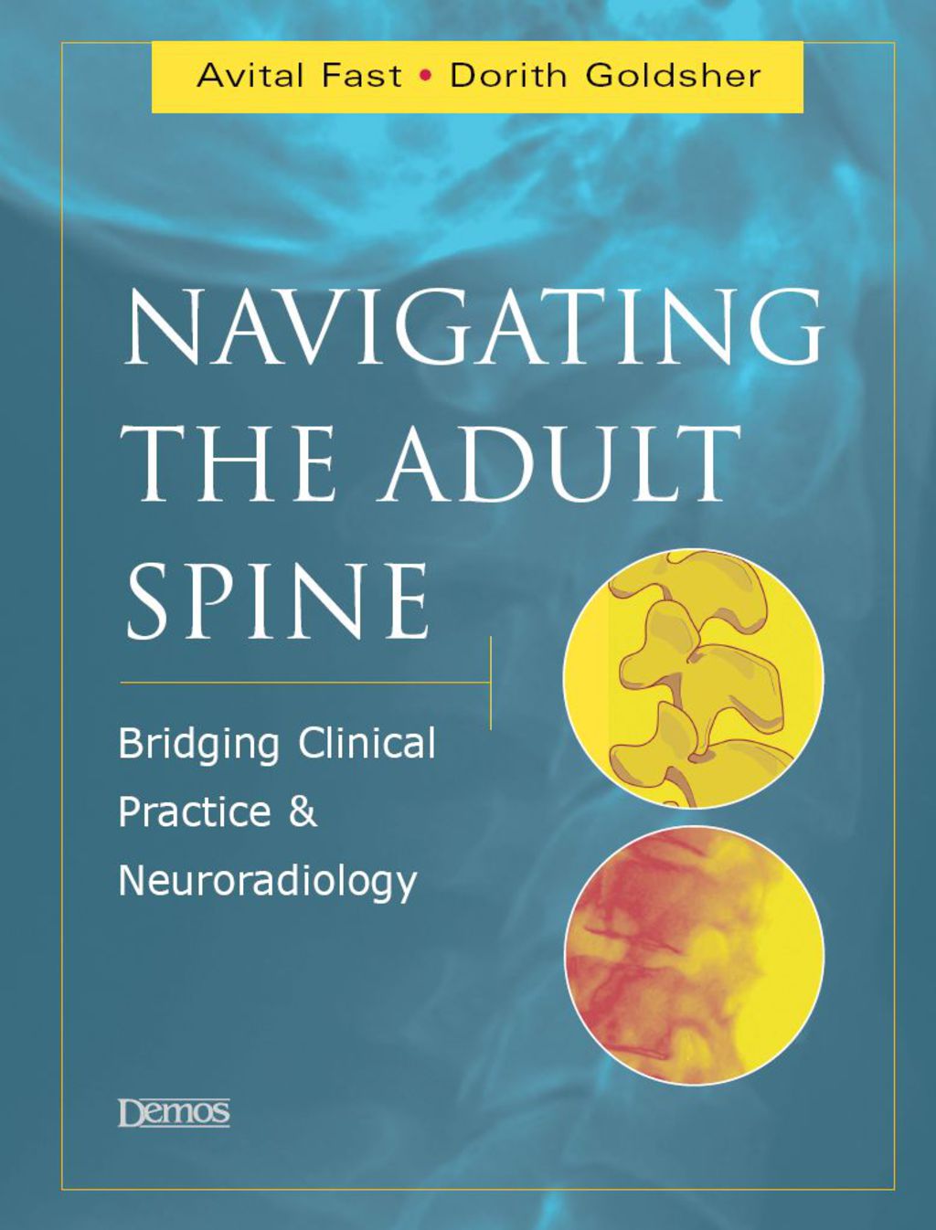 Navigating the Adult Spine Bridging Clinical Practice and Neuroradiology 1st Edition â€“ PDF/EPUB Version Downloadable