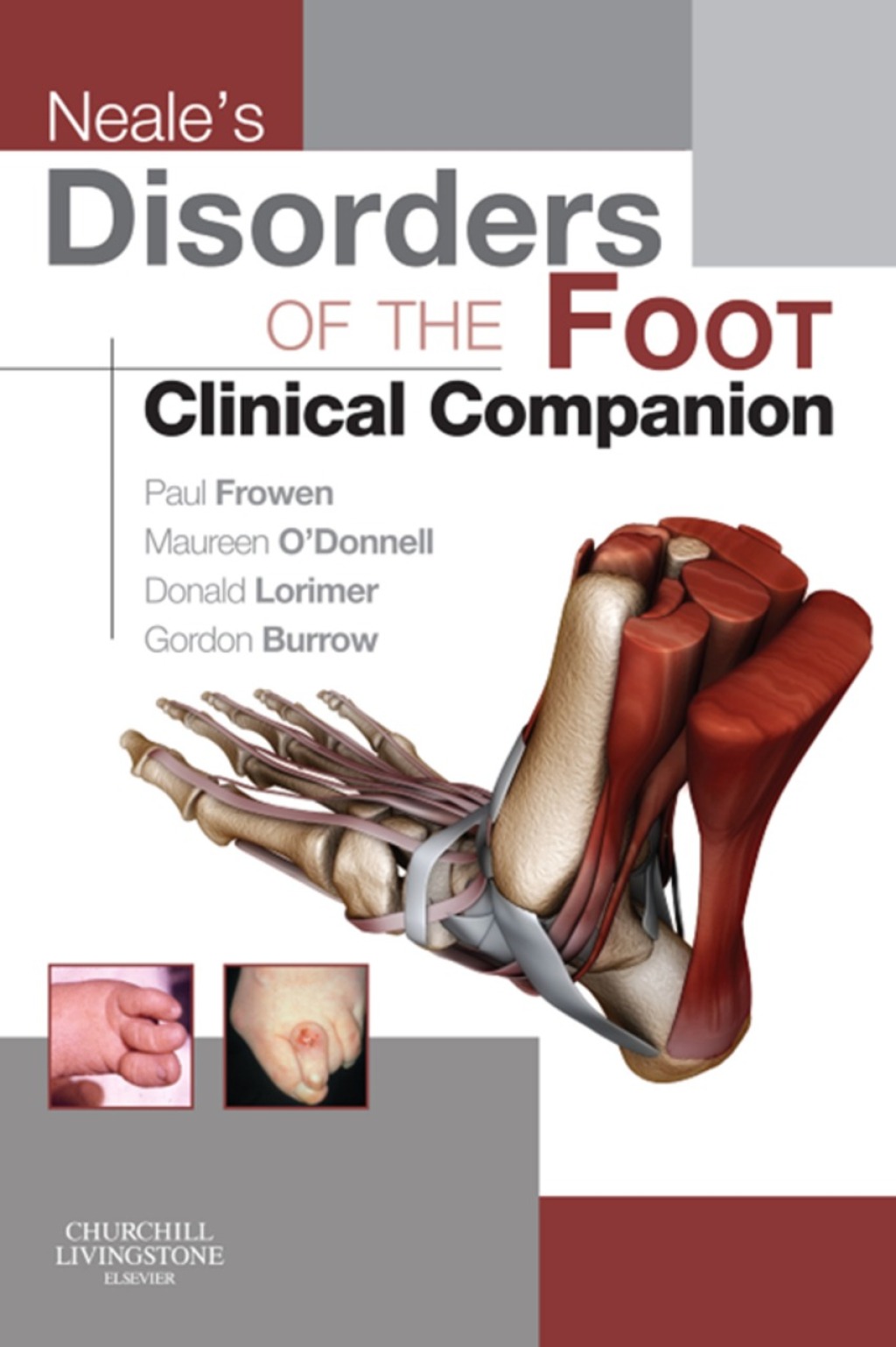 Neale's Disorders of the Foot Clinical Companion  â€“ PDF/EPUB Version Downloadable