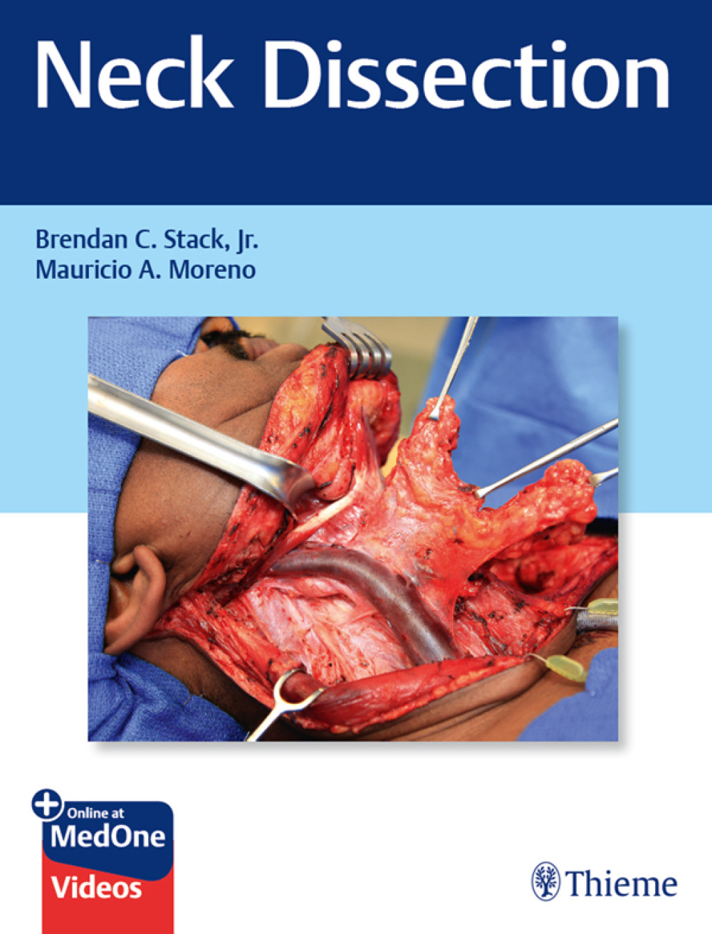 Neck Dissection 1st Edition â€“ PDF/EPUB Version Downloadable