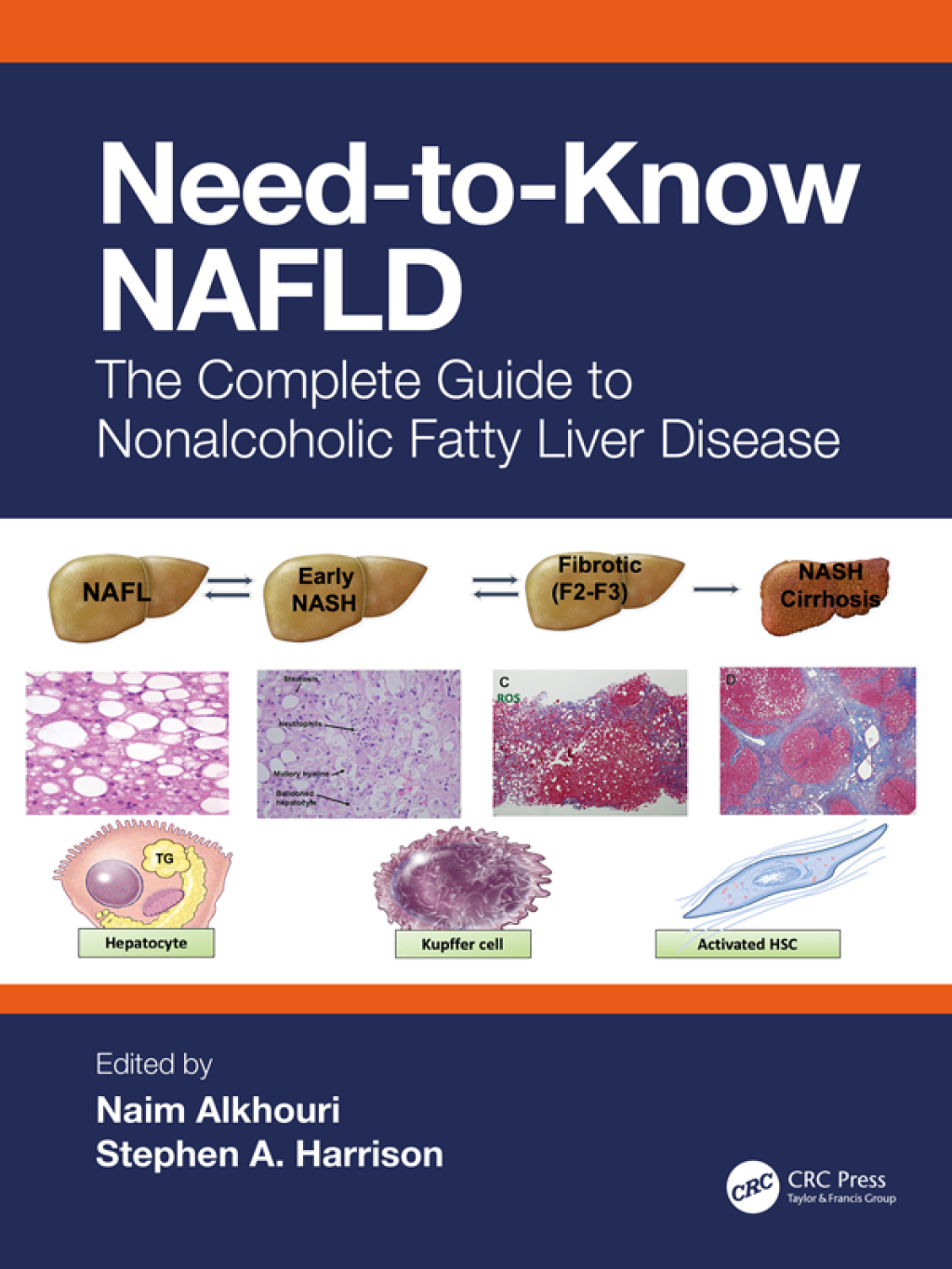 Need-to-Know NAFLD The Complete Guide to Nonalcoholic Fatty Liver Disease 1st Edition â€“ PDF/EPUB Version Downloadable