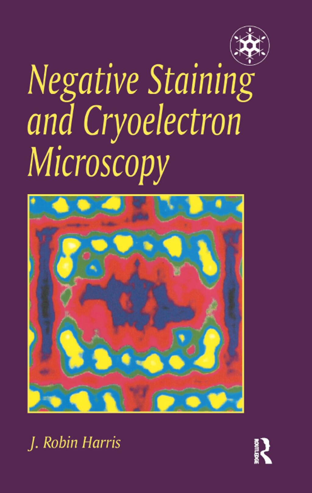 Negative Staining and Cryoelectron Microscopy The Thin Film Techniques 1st Edition â€“ PDF/EPUB Version Downloadable