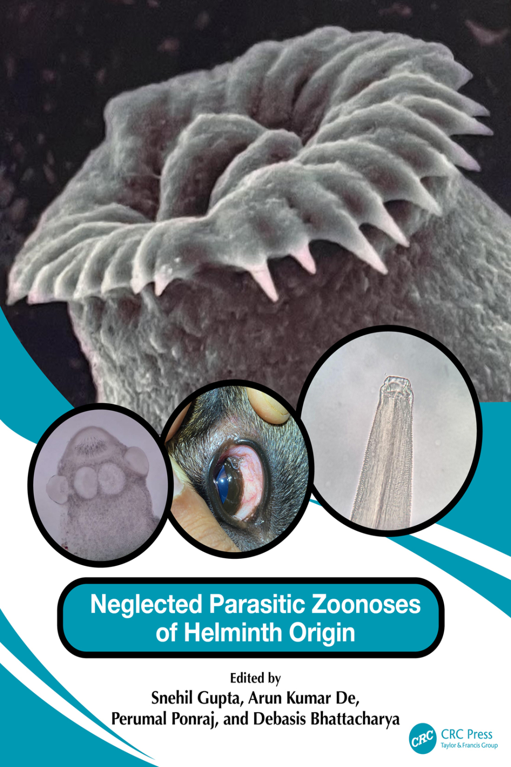 Neglected Parasitic Zoonoses of Helminth Origin 1st Edition â€“ PDF/EPUB Version Downloadable