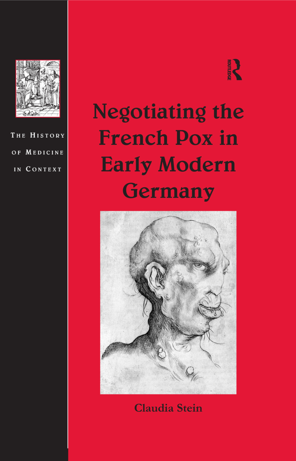 Negotiating the French Pox in Early Modern Germany 1st Edition â€“ PDF/EPUB Version Downloadable