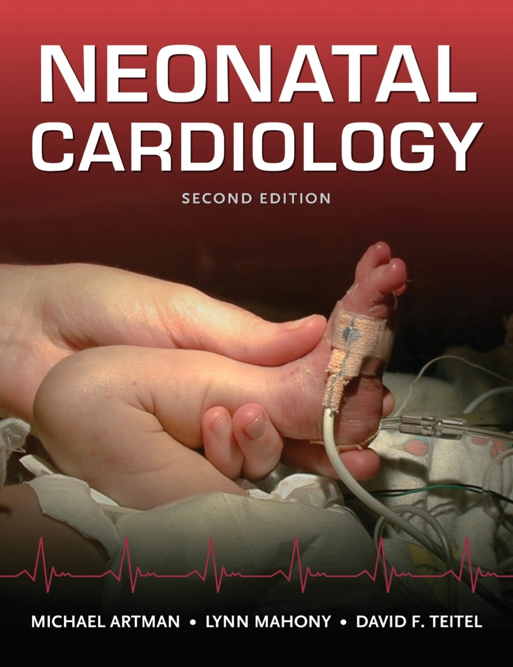 Neonatal Cardiology 2nd Edition â€“ PDF/EPUB Version Downloadable