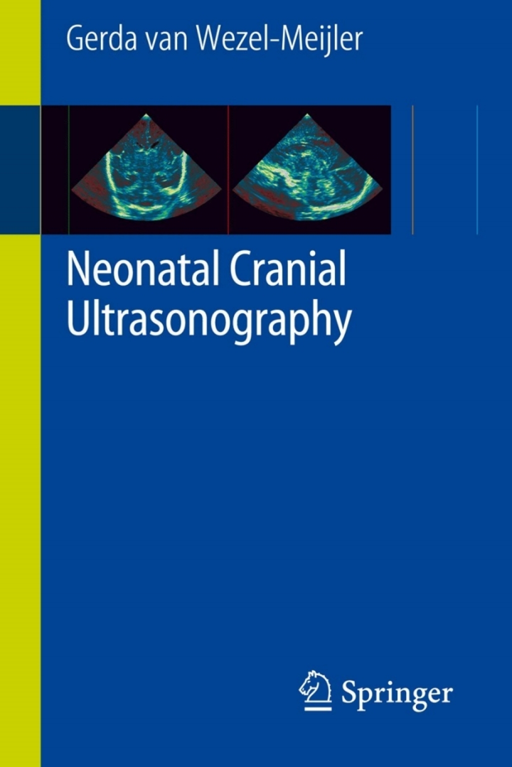 Neonatal Cranial Ultrasonography  â€“ PDF/EPUB Version Downloadable