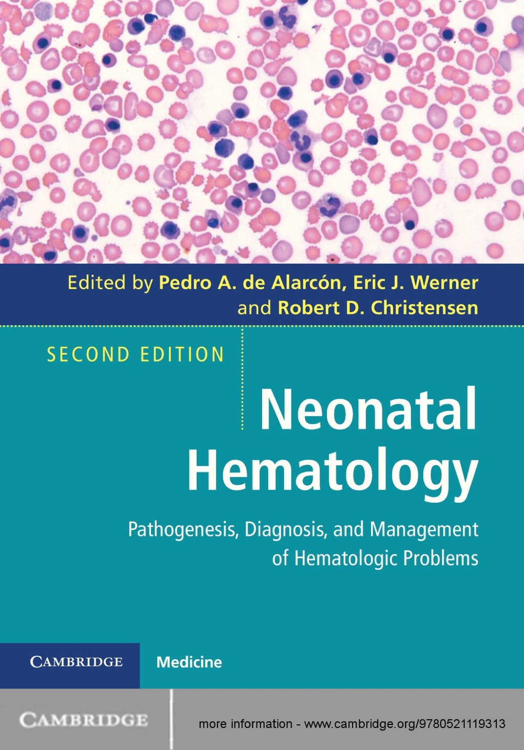 Neonatal Hematology Pathogenesis, Diagnosis, and Management of Hematologic Problems 2nd Edition â€“ PDF/EPUB Version Downloadable