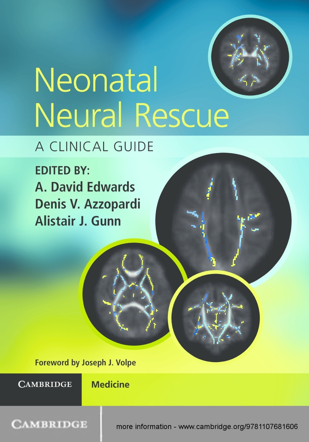 Neonatal Neural Rescue A Clinical Guide 1st Edition â€“ PDF/EPUB Version Downloadable