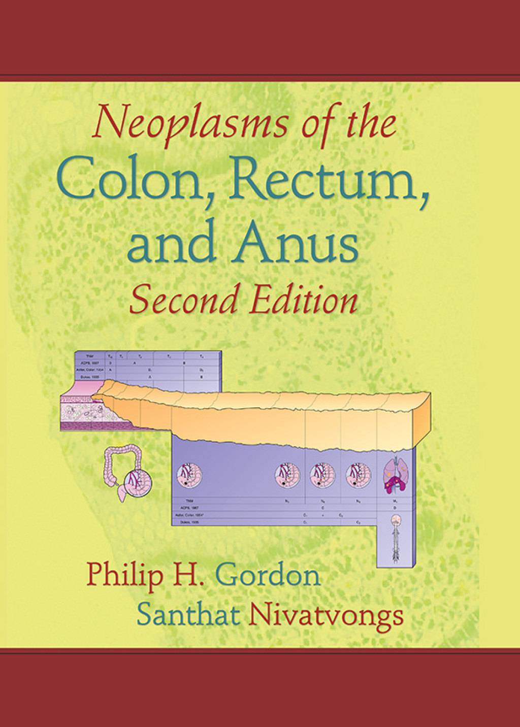 Neoplasms of the Colon, Rectum, and Anus 2nd Edition â€“ PDF/EPUB Version Downloadable