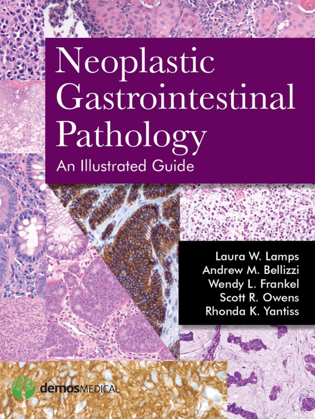 Neoplastic Gastrointestinal Pathology An Illustrated Guide 1st Edition â€“ PDF/EPUB Version Downloadable