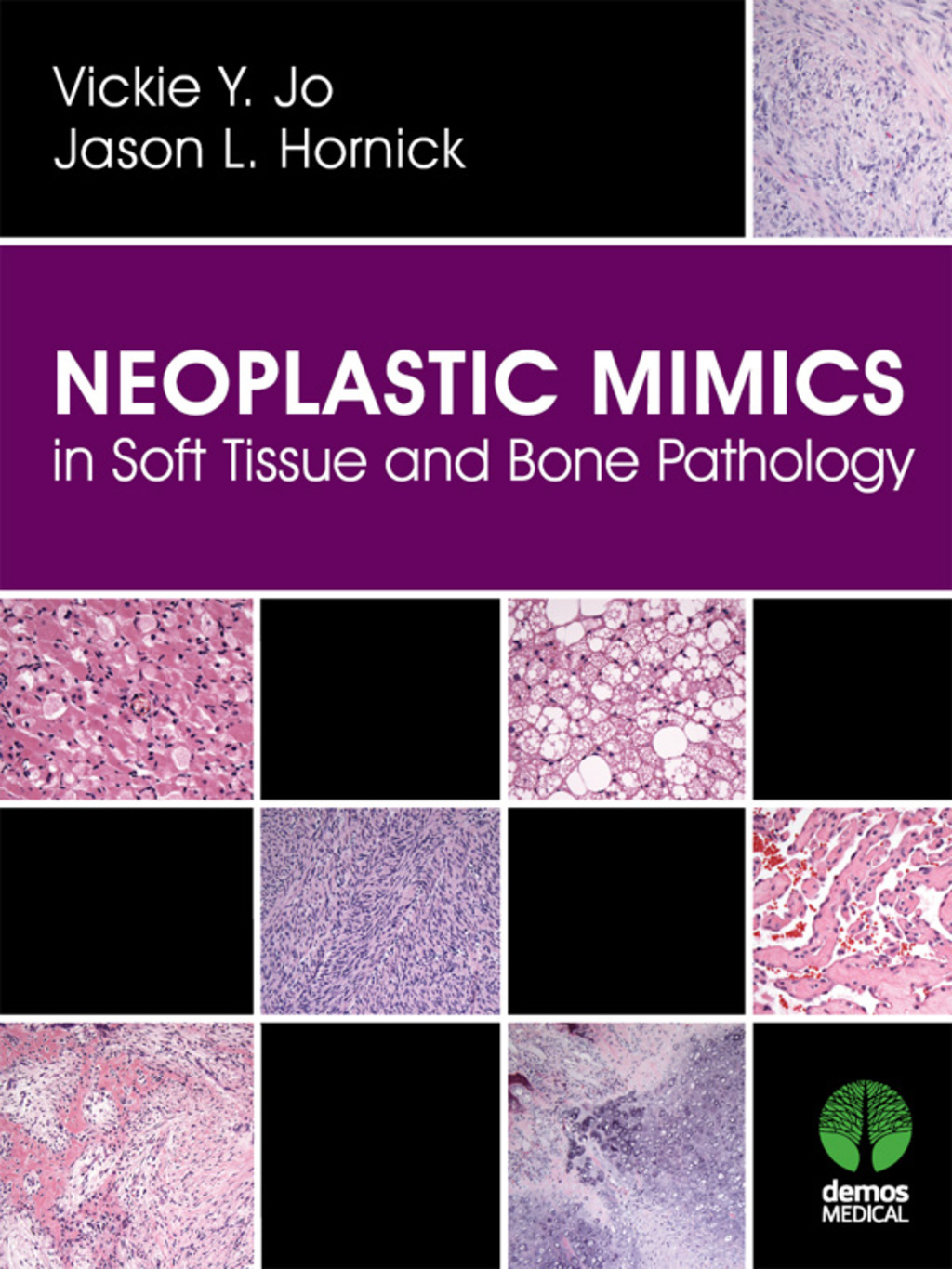 Neoplastic Mimics in Soft Tissue and Bone Pathology 1st Edition â€“ PDF/EPUB Version Downloadable
