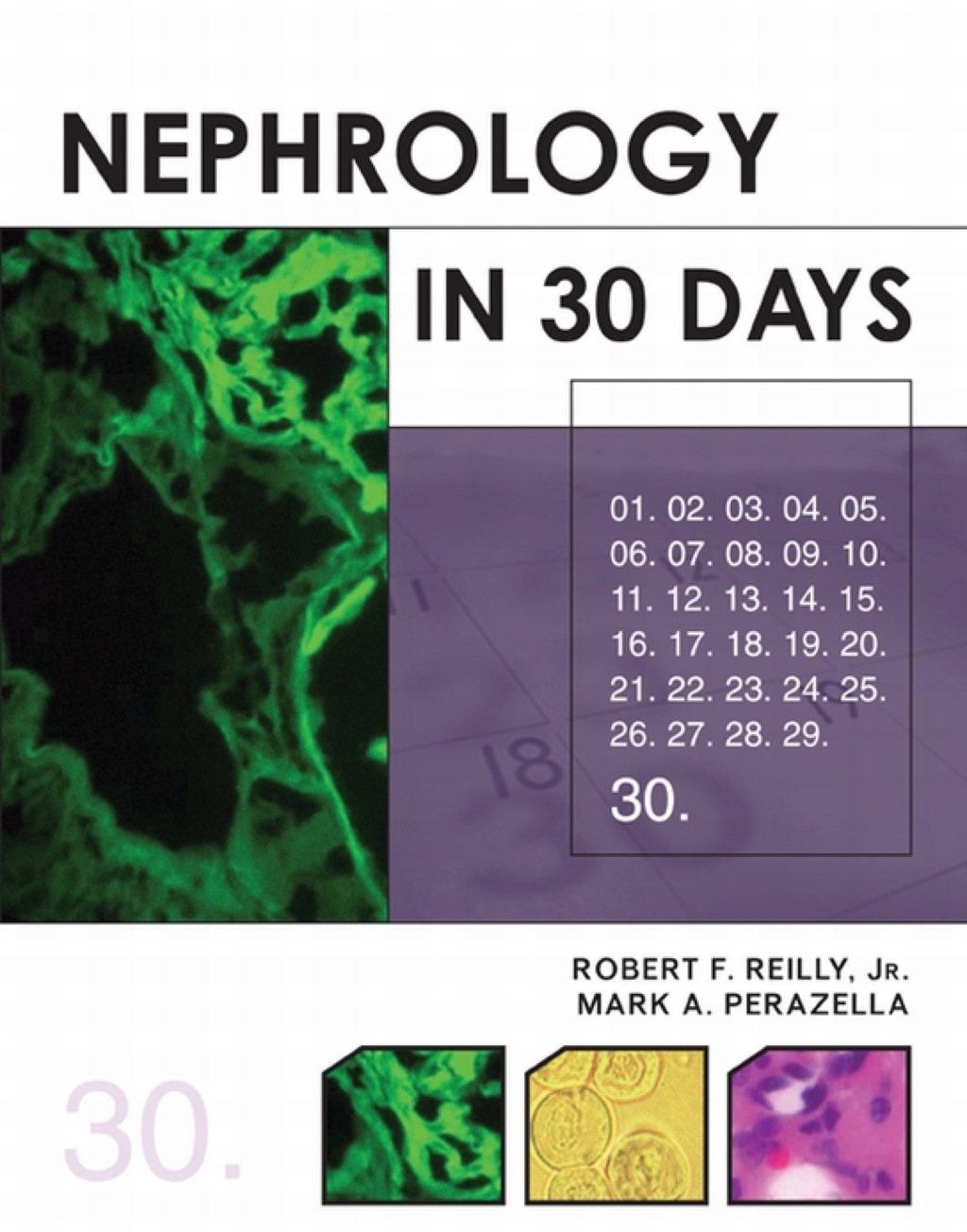 Nephrology in 30 Days 1st Edition â€“ PDF/EPUB Version Downloadable