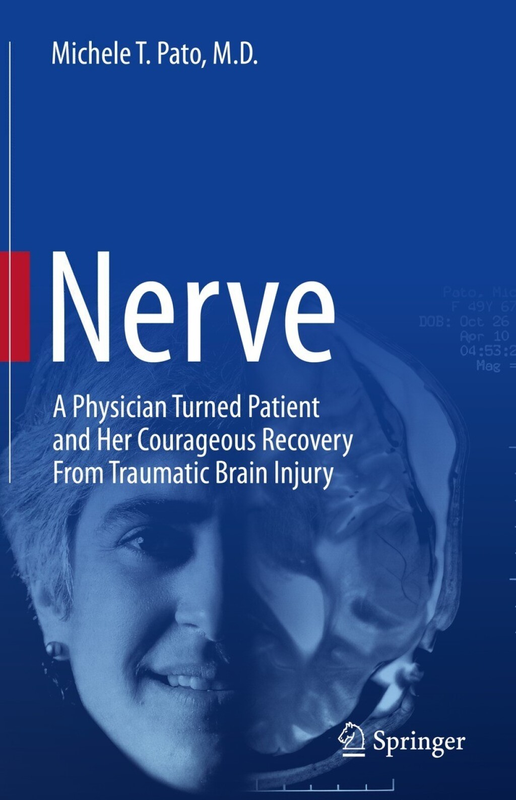 Nerve A Physician Turned Patient and Her Courageous Recovery From Traumatic Brain Injury  â€“ PDF/EPUB Version Downloadable