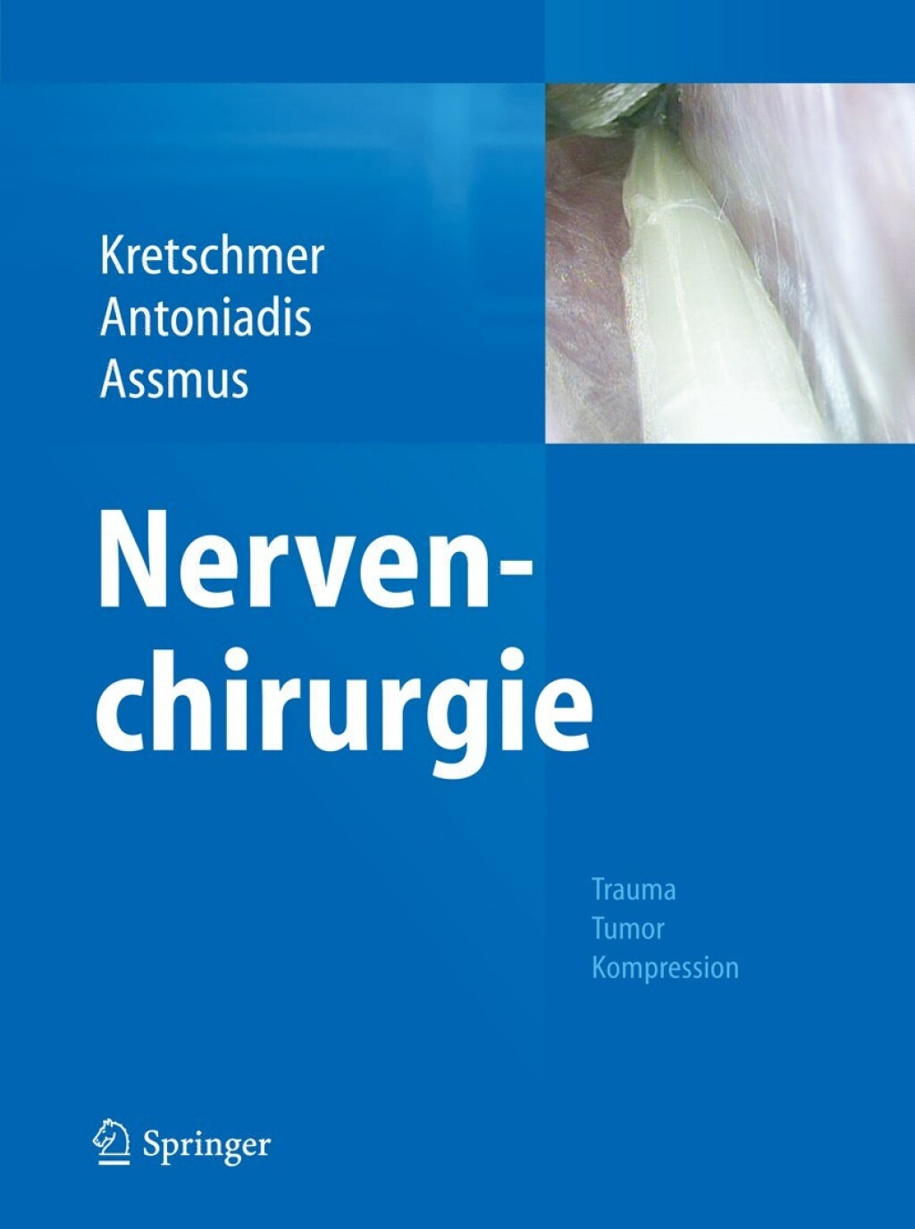 Nervenchirurgie Trauma, Tumor, Kompression  â€“ PDF/EPUB Version Downloadable