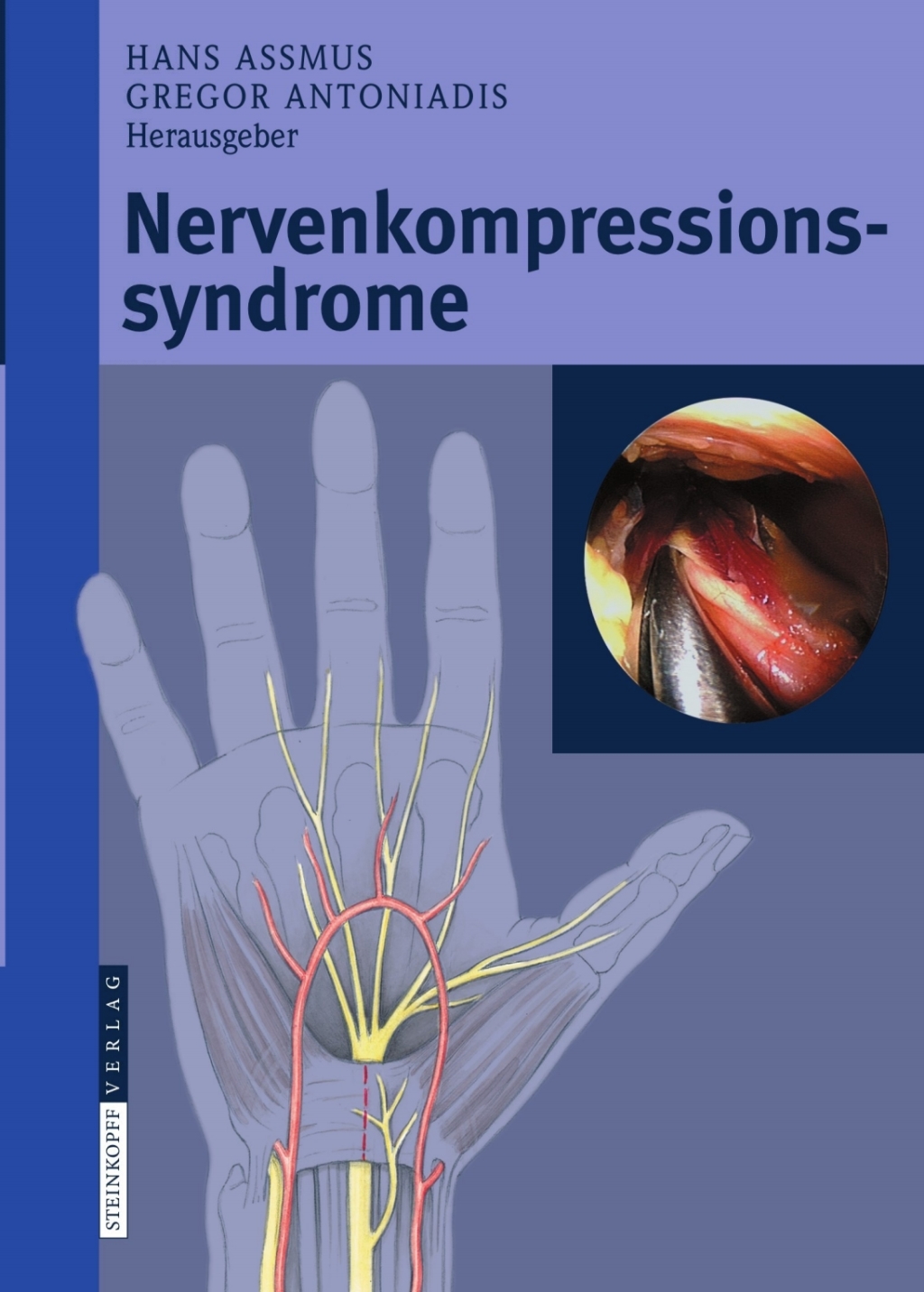 Nervenkompressionssyndrome  â€“ PDF/EPUB Version Downloadable