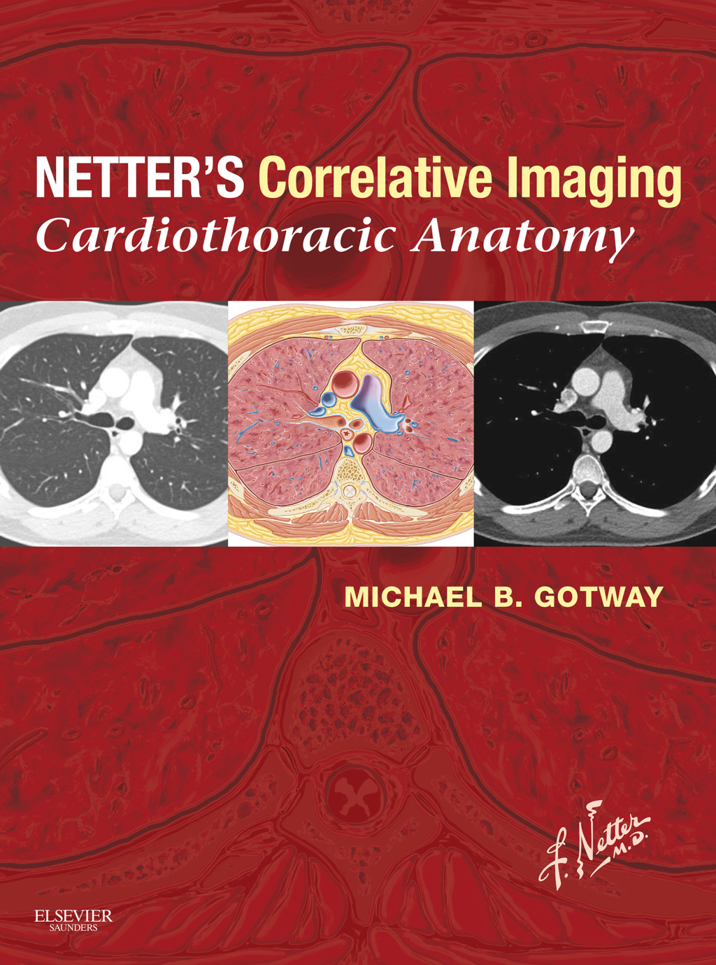 Netterâ€™s Correlative Imaging: Cardiothoracic Anatomy with Online Access at www.NetterReference.com  â€“ PDF/EPUB Version Downloadable